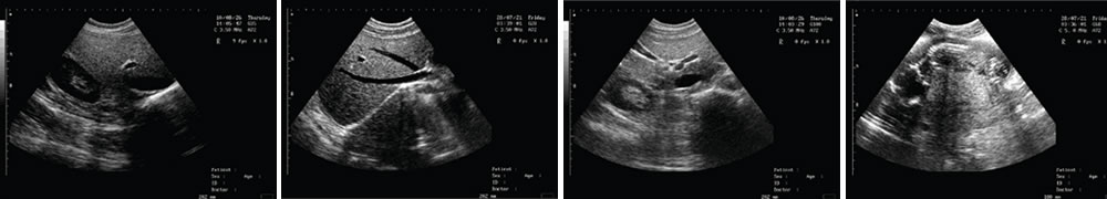 V-218全數(shù)字筆記本式動(dòng)物超聲診斷儀(動(dòng)物版)一流的數(shù)字成像技術(shù)，圖像更清晰